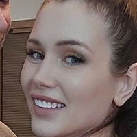 mosttalentedbaldman Çıplak